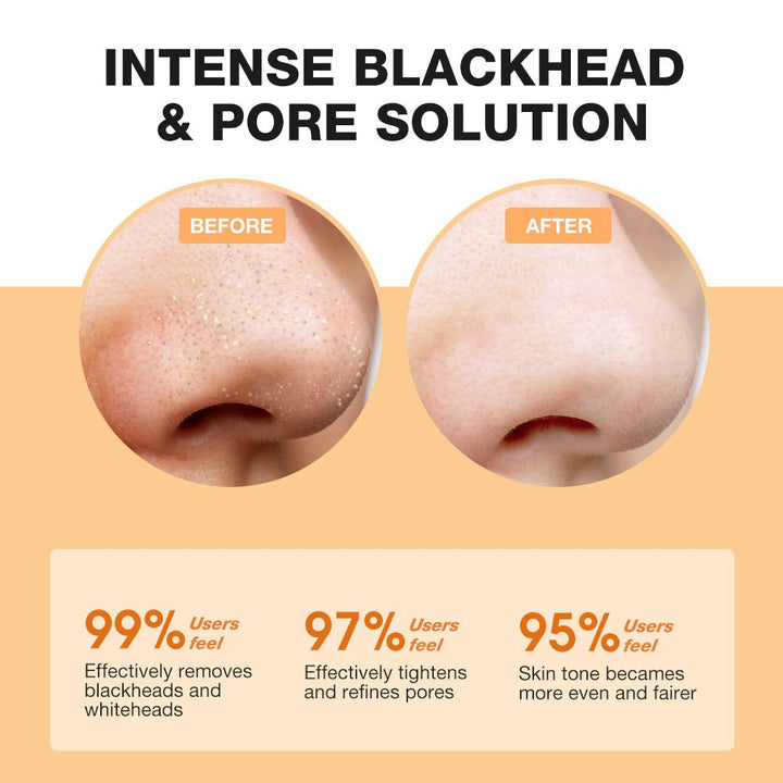 SKINEVER Glycolic Acid Deep Peeling Solution - SKINEVER - 