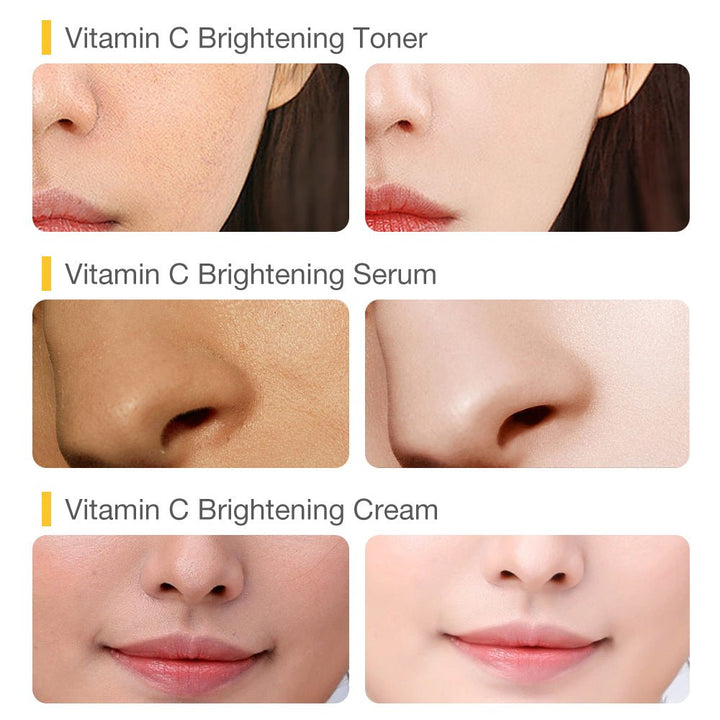 VC Brightening 5 - Step Set - SKINEVER - 