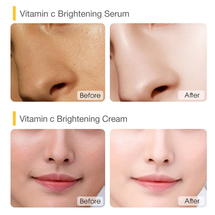 VC Brightening Skincare Base Set - SKINEVER - 
