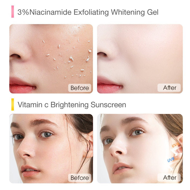 Vitamin C Brightening Sunscreen & 3% Niacinamide Exfoliating Whitening Gel - SKINEVER - 